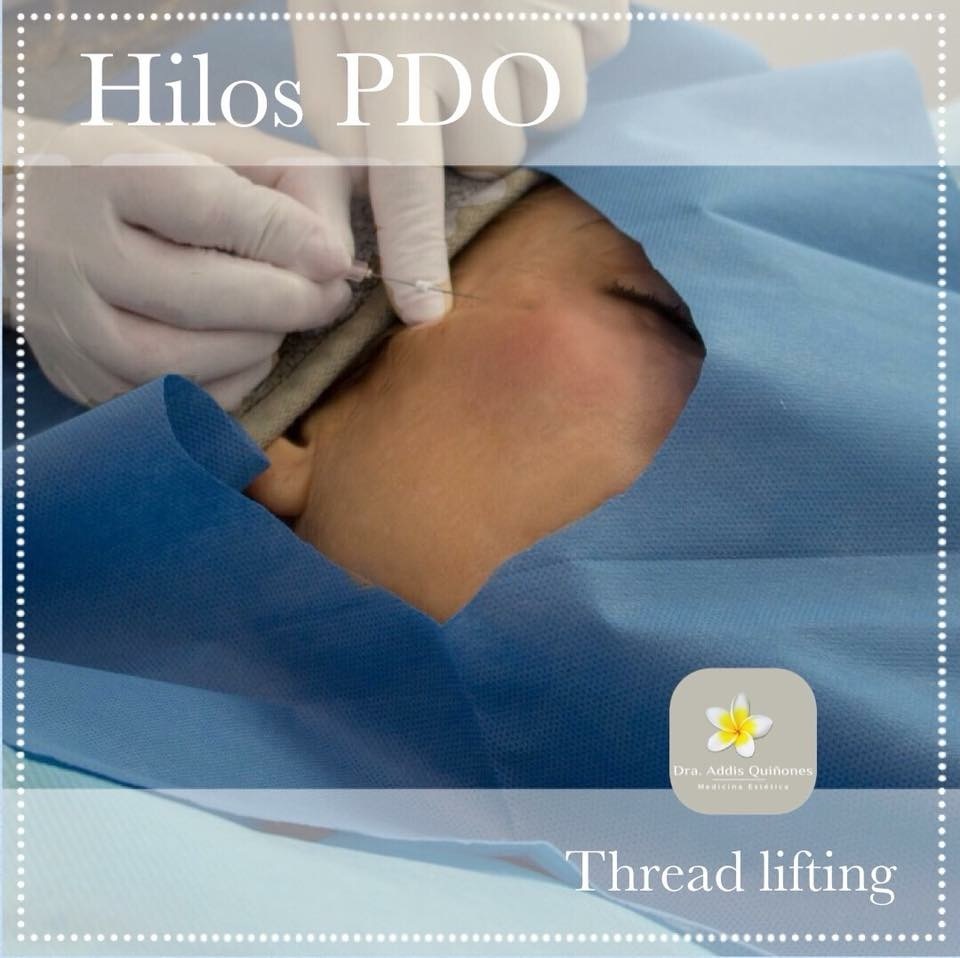 Hilos PDO.