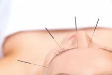 Facial Acupuncture