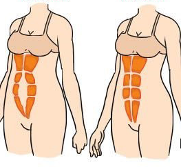 Rectus Diastasis Repair Chicago - Abdominal Separation After Pregnancy