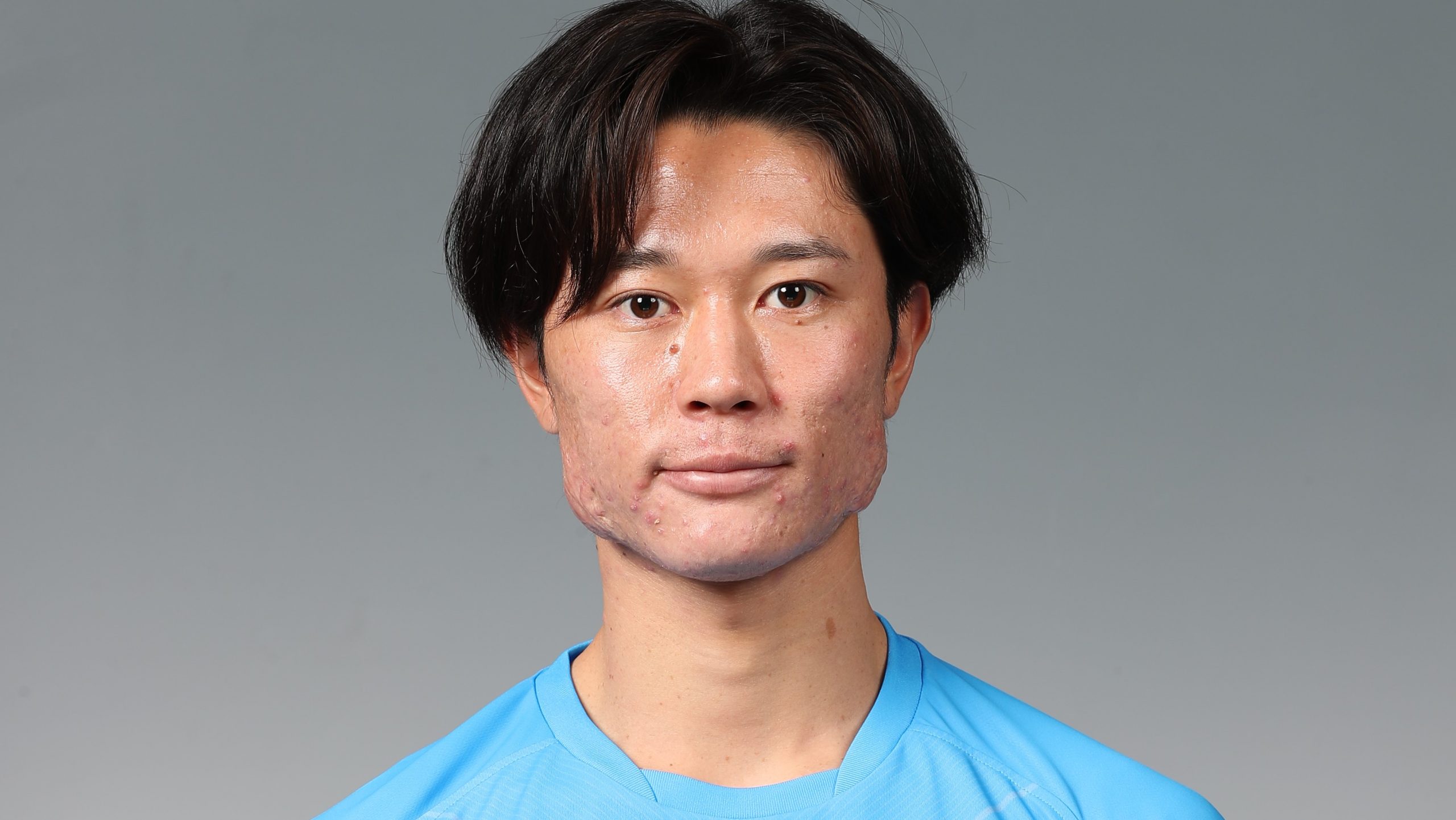 MF齋藤功佑選手の負傷について | 横浜FCオフィシャルウェブサイト MF齋藤功佑選手の負傷について | 横浜FCオフィシャルウェブサイト