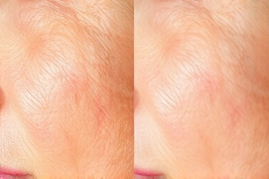 Skin transformation from dull to radiant with hydration