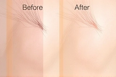 Close-up of smooth, radiant skin after hair removal.