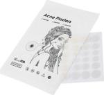 Acne Pimple Master 24 Patch - Sivilce Bandı