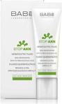 Babe Stop AKN Keratolytic Fluid 30 ml Sivilce Kremi