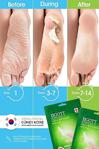 Jigott Çorap Tipi Soyulan Ayak Peeling Maskesi - Miracle Foot Peeling Pack