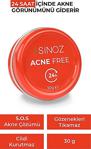 Sinoz Acne Free Pürüzsüzleştirici Lokal Akne Kremi 30 Gr