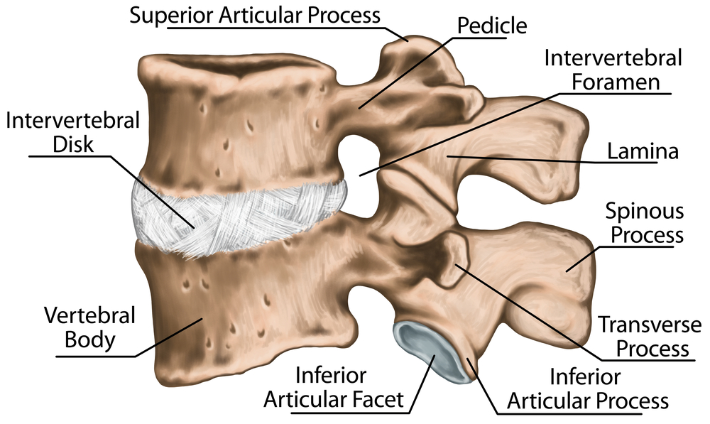 narrowing of the space in between vertebrae