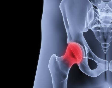 What is causing my hip pain?