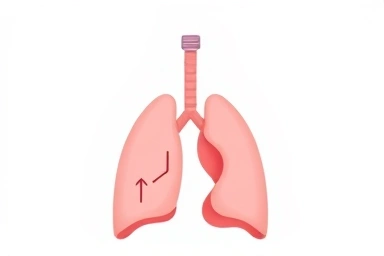 Medical illustration of GERD affecting lungs