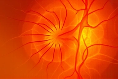 Microscopic view of healthy retinal blood vessels with astaxanthin