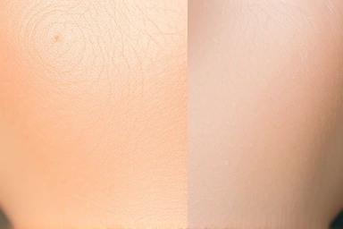 Abstract skin texture showing warm and cool undertones with ingredient lines.