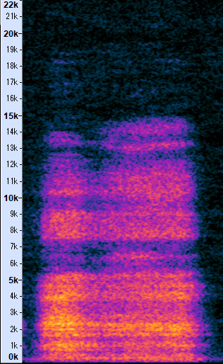 吸気音のスペクトログラム