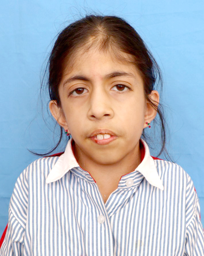 NAVYA