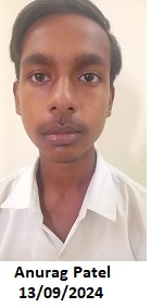 ANURAG