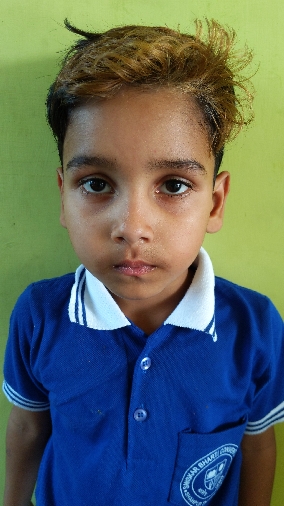 SAAD