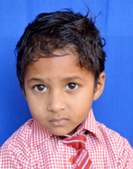 Parv